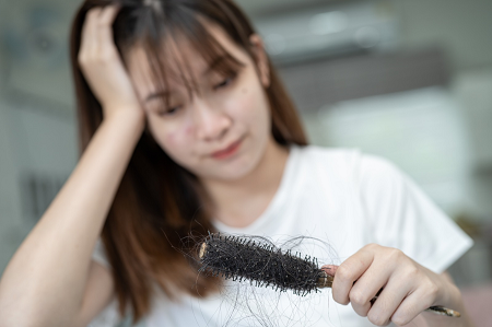 Kenali Alopecia Androgenetika, Penyebab Rambut Rontok Parah pada Pria dan Wanita